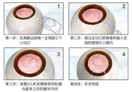 微信图片_20221219150949.png